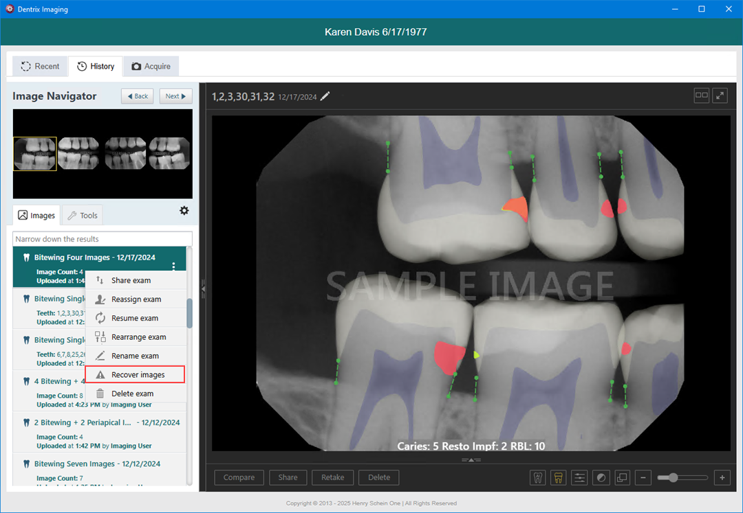 Recovering images